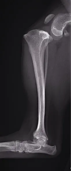 前十字靭帯断裂（TPLO 脛骨高平部水平化骨切術） 術前