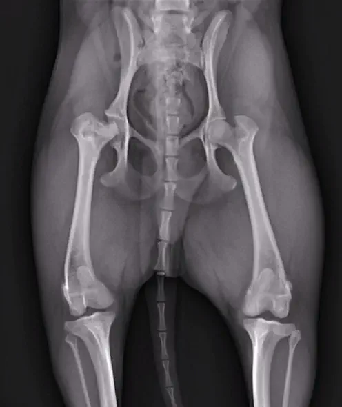 レッグペルテス（大腿骨頭切除術） 術前