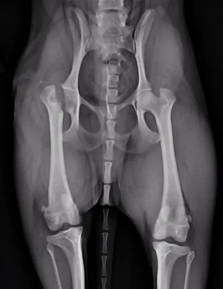 レッグペルテス（大腿骨頭切除術） 術後